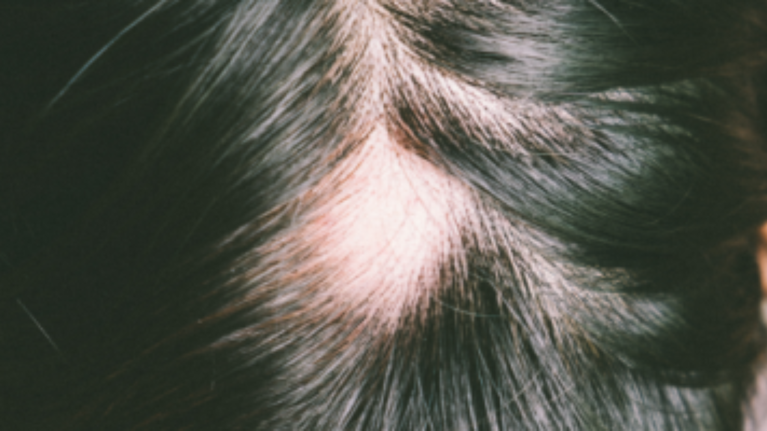 alopecia